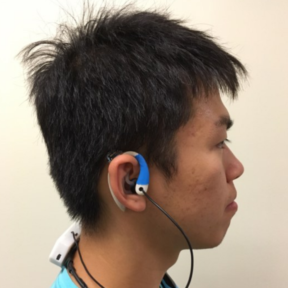 Headshot of Richard wearing a device around the ear wired to a device around the neck