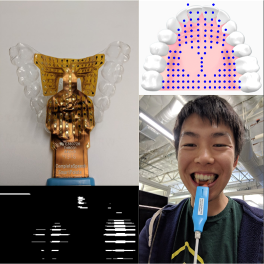 Collage of a retainer with electronics, Richard wearing the retainer, and visual representations of data from the retainer